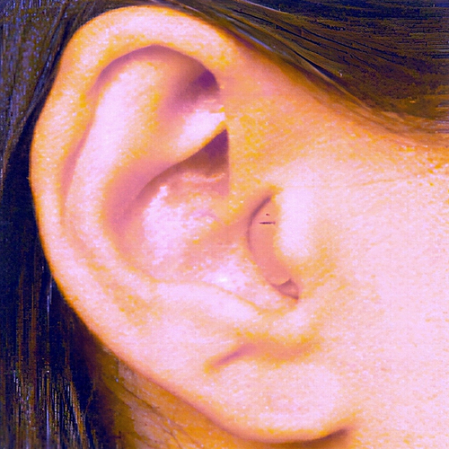 CIC (Completely In Canal) hearing aid example