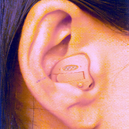 Half Shell hearing aid example