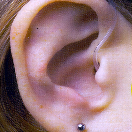 Mini BTE hearing aid example