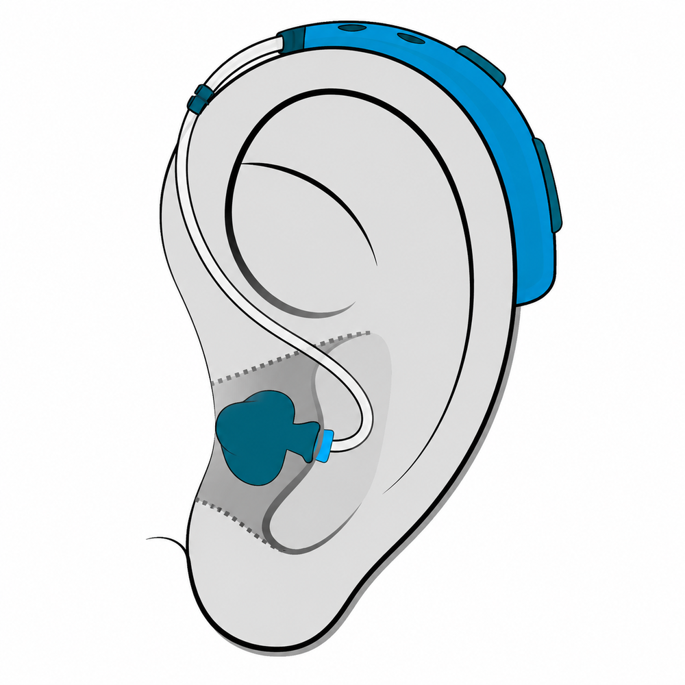 Behind-the-Ear (BTE) hearing aid style fit at Contra Costa Hearing Aid Center in Brentwood, CA