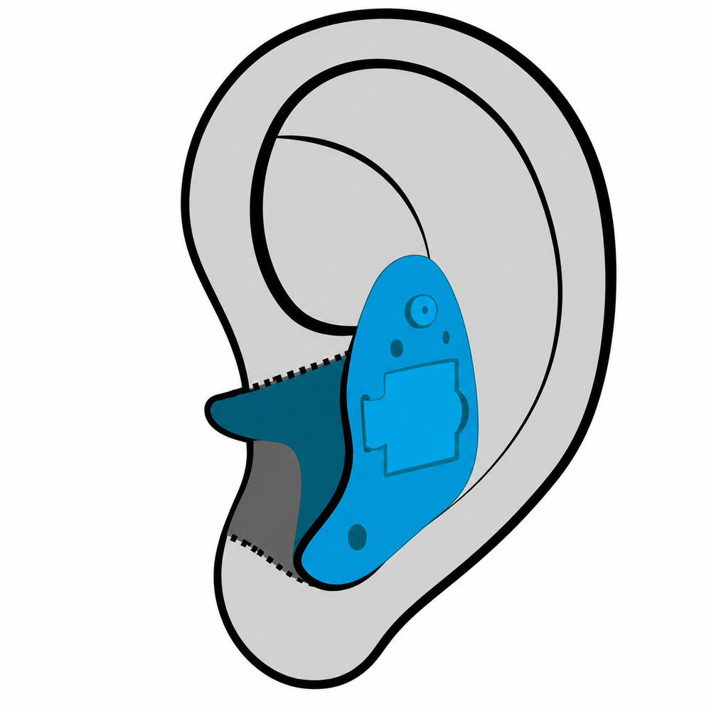 In-the-Ear (ITE) hearing aid style fit at Contra Costa Hearing Aid Center in Walnut Creek, CA