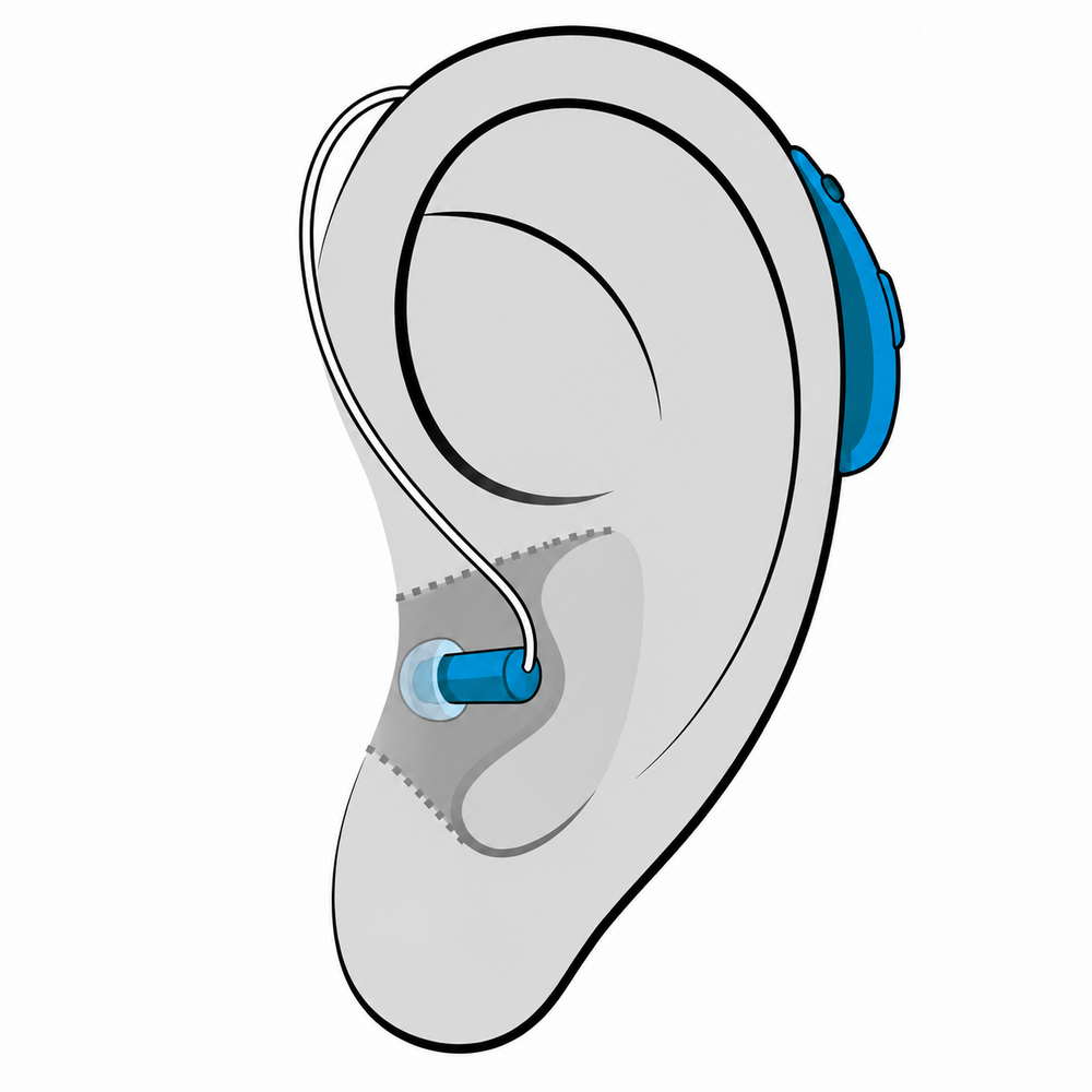 Receiver-in-Canal (RIC) hearing aid style fit at Contra Costa Hearing Aid Center in Walnut Creek, CA